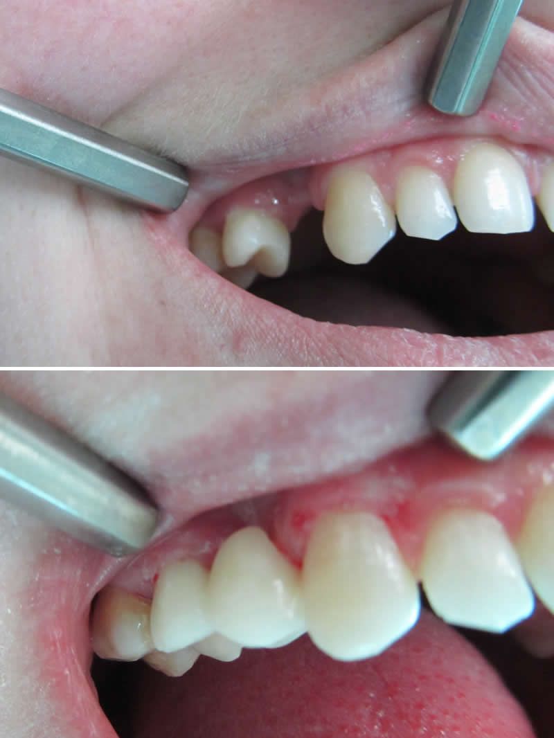 ХУДОЖЕСТВЕННАЯ РЕСТАВРАЦИЯ ЗУБОВ