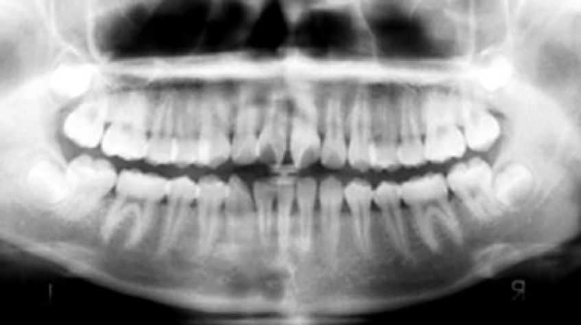 ПАНОРАМНЫЙ СНИМОК