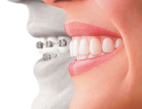 Ортодонтия