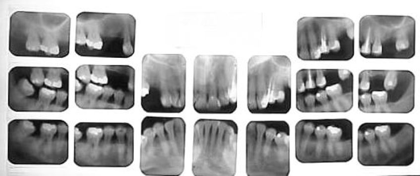 Дентальные снимки